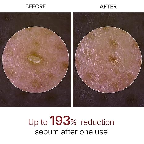 [Dr. Melaxin] Peel Shot Glow White Rice Peeling Ampoule (2.7 fl.oz / 80ml)