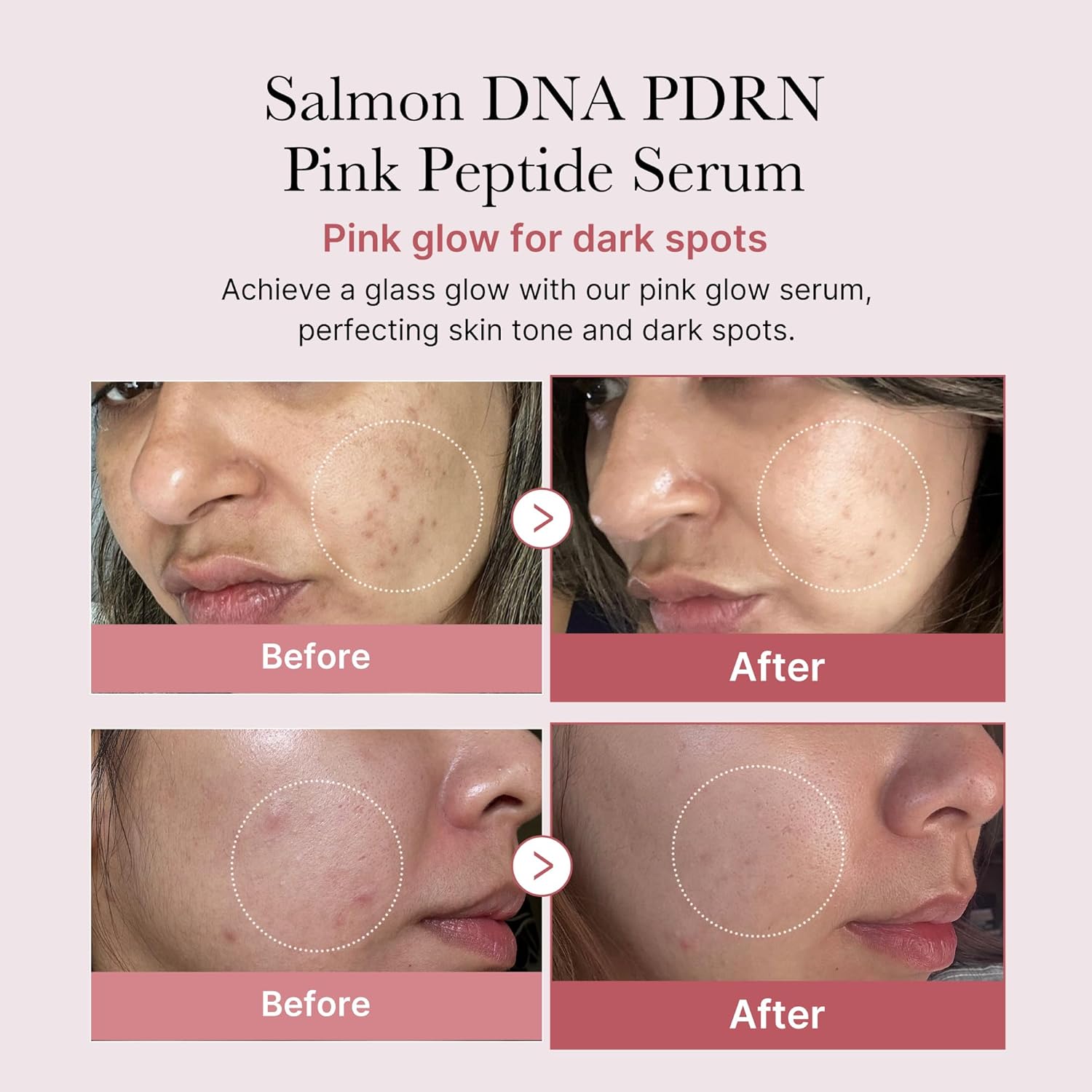 [Medicube] Salmon DNA PDRN Pink Peptide Serum (1.01 fl.oz / 30ml)