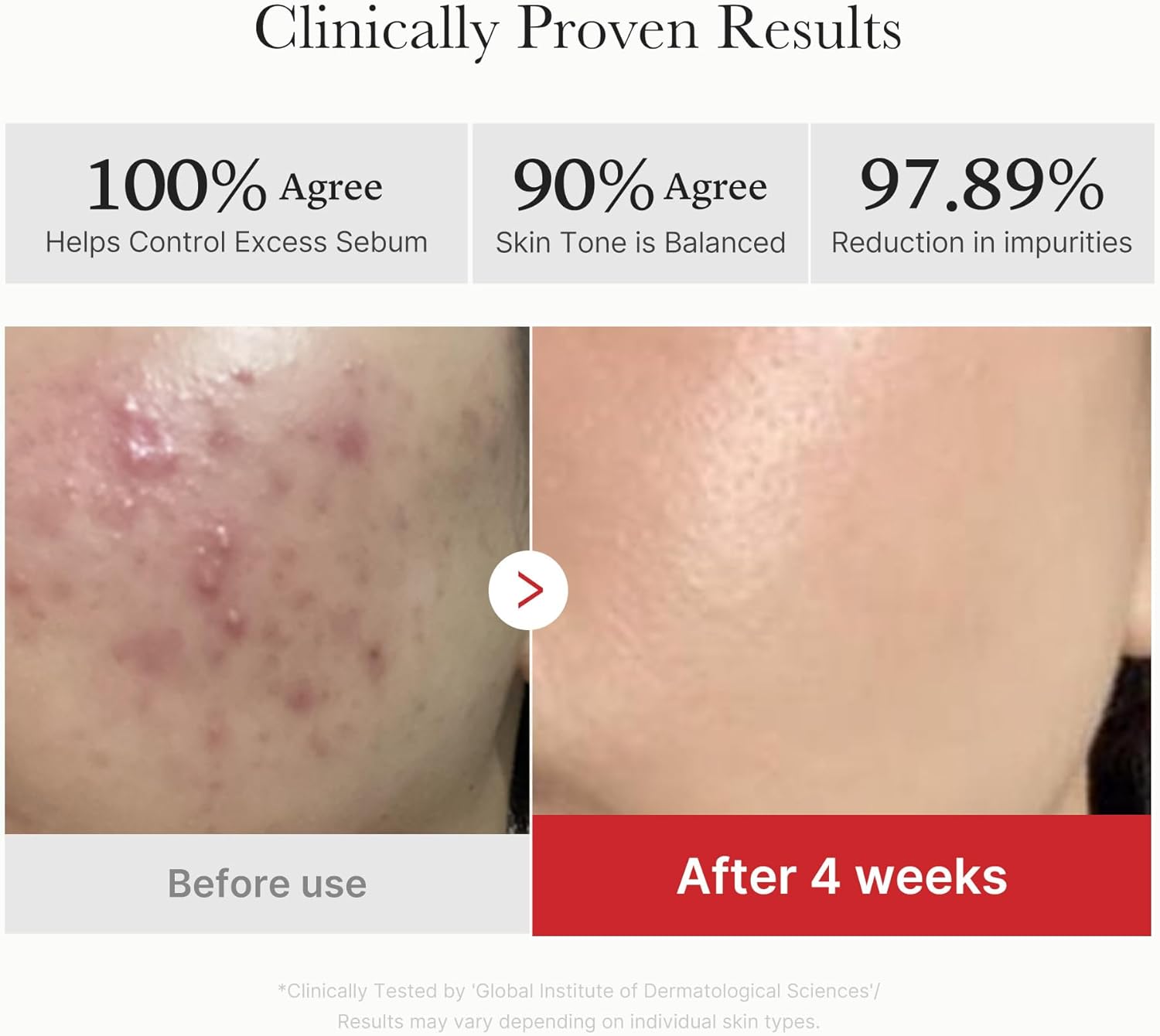 Set 2: Clear Skin Pack (Acne & Breakouts)